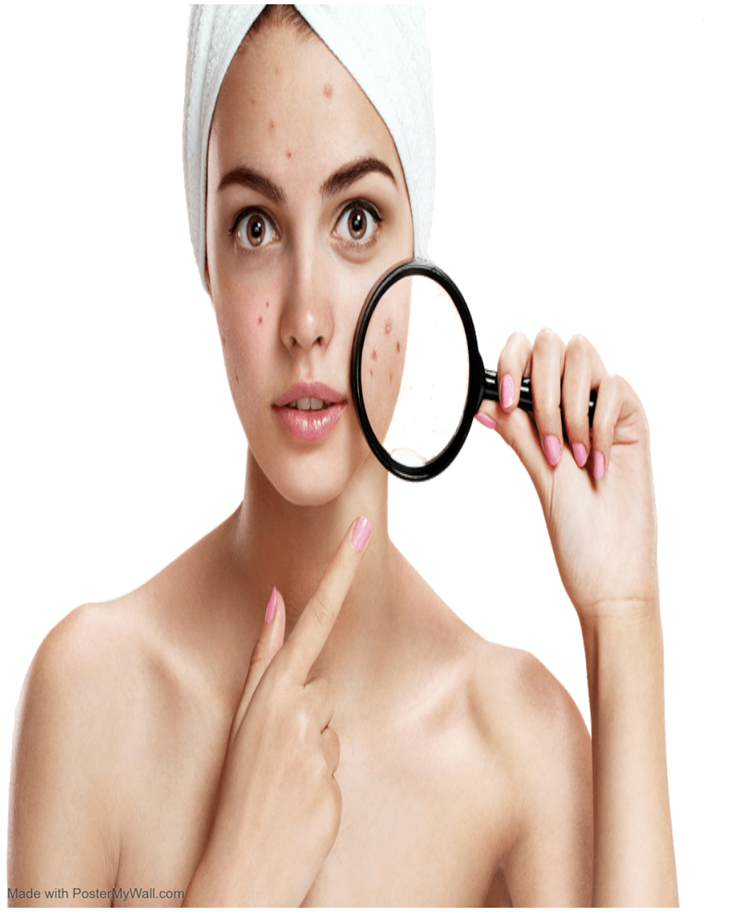 Tratamiento Facial Antiacné